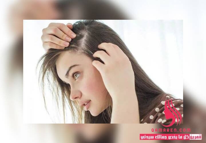 تساقط الشعر - أفضل 12 طريقة للحد من تساقط الشعر