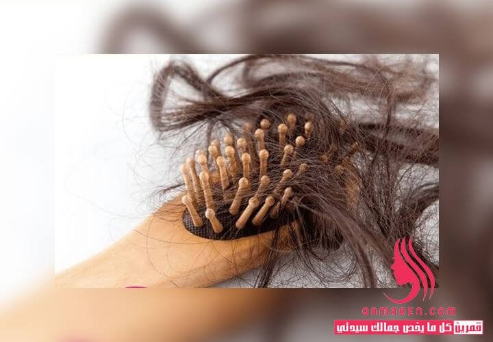 تساقط الشعر - أهم 10 علاجات فعالة لتساقط الشعر
